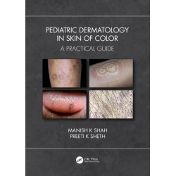 Pediatric Dermatology in Skin of Color: A Practical Guide