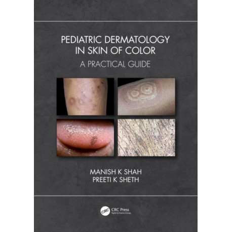 Pediatric Dermatology in Skin of Color: A Practical Guide