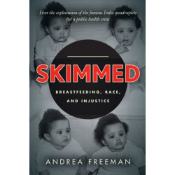 Skimmed: Breastfeeding, Race, and Injustice