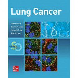 Lung Cancer:  Standards of Care