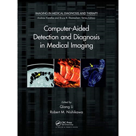 Computer-Aided Detection and Diagnosis in Medical Imaging