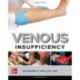 Venous Insufficiency