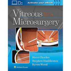 Vitreous Microsurgery