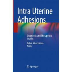 Intra Uterine Adhesions: Diagnostic and Therapeutic Insight