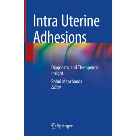 Intra Uterine Adhesions: Diagnostic and Therapeutic Insight