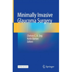 Minimally Invasive Glaucoma Surgery