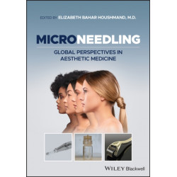 Microneedling: Global Perspectives in Aesthetic Medicine