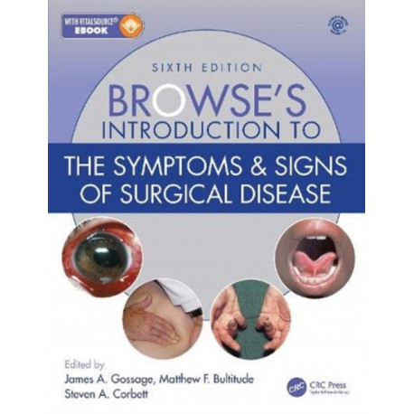 Browse's Introduction to the Symptoms & Signs of Surgical Disease