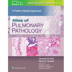 Atlas of Pulmonary Pathology: A Pattern Based Approach