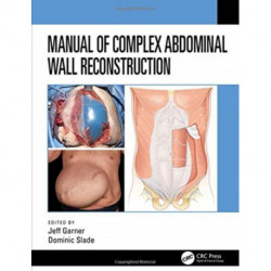 Manual of Complex Abdominal Wall Reconstruction