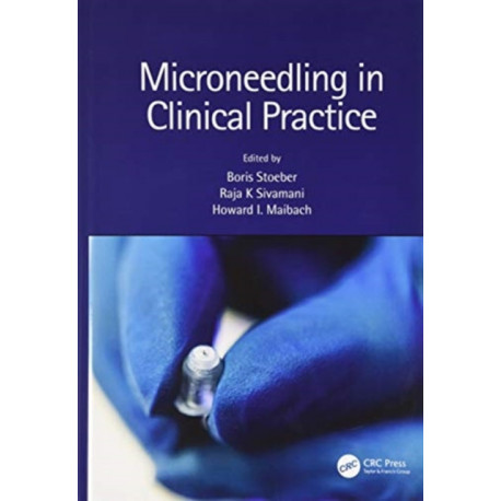 Microneedling in Clinical Practice
