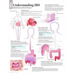 Understanding IBD
