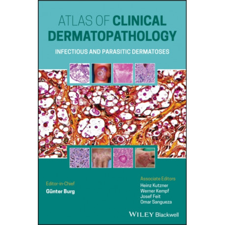 Atlas of Clinical Dermatopathology: Infectious and Parasitic Dermatoses