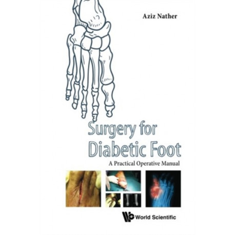 Surgery For Diabetic Foot: A Practical Operative Manual