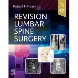 Revision Lumbar Spine Surgery