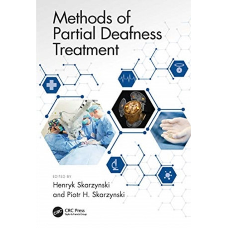 Methods of Partial Deafness Treatment