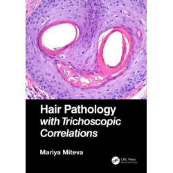 Hair Pathology with Trichoscopic Correlations