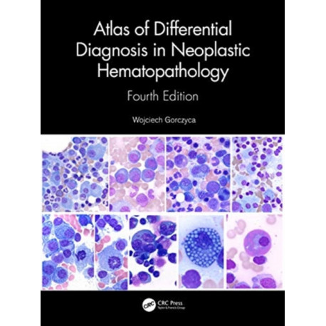 Atlas of Differential Diagnosis in Neoplastic Hematopathology