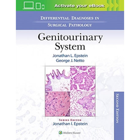 Differential Diagnoses in Surgical Pathology: Genitourinary System