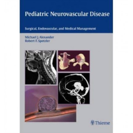Pediatric Neurovascular Disease: Surgical, Endovascular and Medical Management