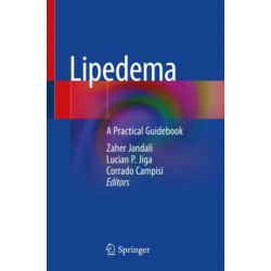 Lipedema: A Practical Guidebook