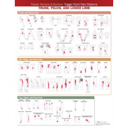 Travell, Simons & Simons’ Trigger Point Pain Patterns Wall Chart: Trunk, Pelvis, and Lower Limb