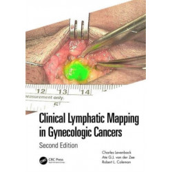 Clinical Lymphatic Mapping in Gynecologic Cancers