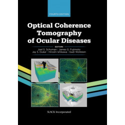Optical Coherence Tomography of Ocular Diseases