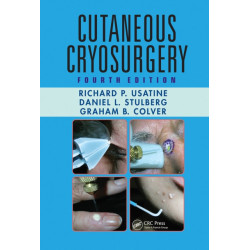 Cutaneous Cryosurgery: Principles and Clinical Practice