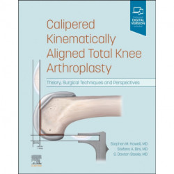 Calipered Kinematically aligned Total Knee Arthroplasty: Theory, Surgical Techniques and Perspectives