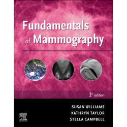 Fundamentals of Mammography