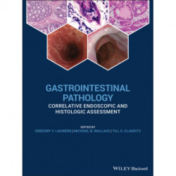 Gastrointestinal Pathology: Correlative Endoscopic and Histologic Assessment
