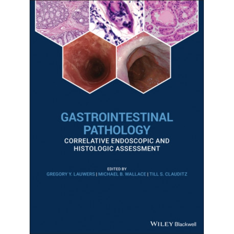 Gastrointestinal Pathology: Correlative Endoscopic and Histologic Assessment