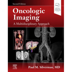 Oncologic Imaging: A Multidisciplinary Approach: Expert Consult - Online and Print
