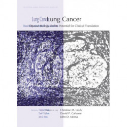 Lung Cancer: Disease Biology and Its Potential for Clinical Translation