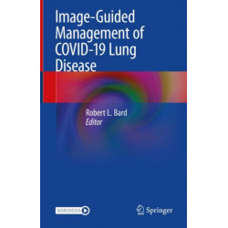 Image-Guided Management of COVID-19 Lung Disease