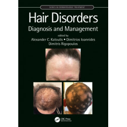 Hair Disorders: Diagnosis and Management