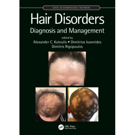 Hair Disorders: Diagnosis and Management