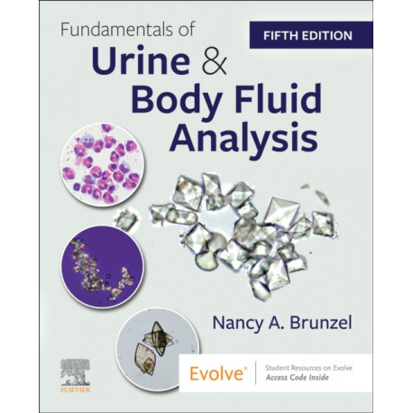 Fundamentals of Urine and Body Fluid Analysis