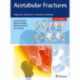 Acetabular Fractures: Diagnosis, Indications, Treatment Strategies