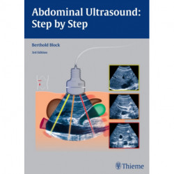 Abdominal Ultrasound: Step by Step