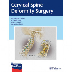 Cervical Spine Deformity Surgery