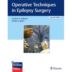 Operative Techniques in Epilepsy Surgery
