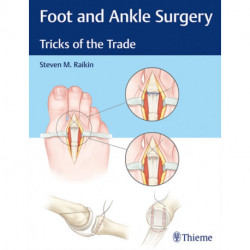 Foot and Ankle Surgery: Tricks of the Trade