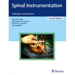 Spinal Instrumentation: Challenges and Solutions