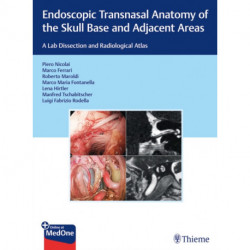 Endoscopic Transnasal Anatomy of the Skull Base and Adjacent Areas: A Lab Dissection and Radiological Atlas