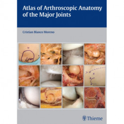 Atlas of Arthroscopic Anatomy of the Major Joints