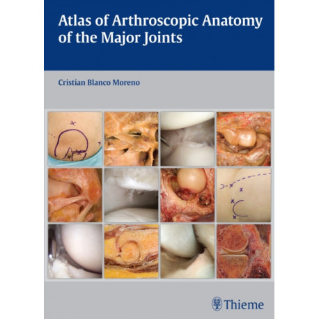 Atlas of Arthroscopic Anatomy of the Major Joints