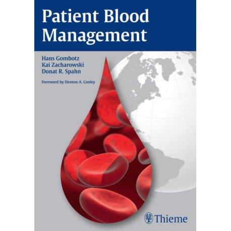 Patient Blood Management