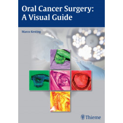 Oral Cancer Surgery: A Visual Guide